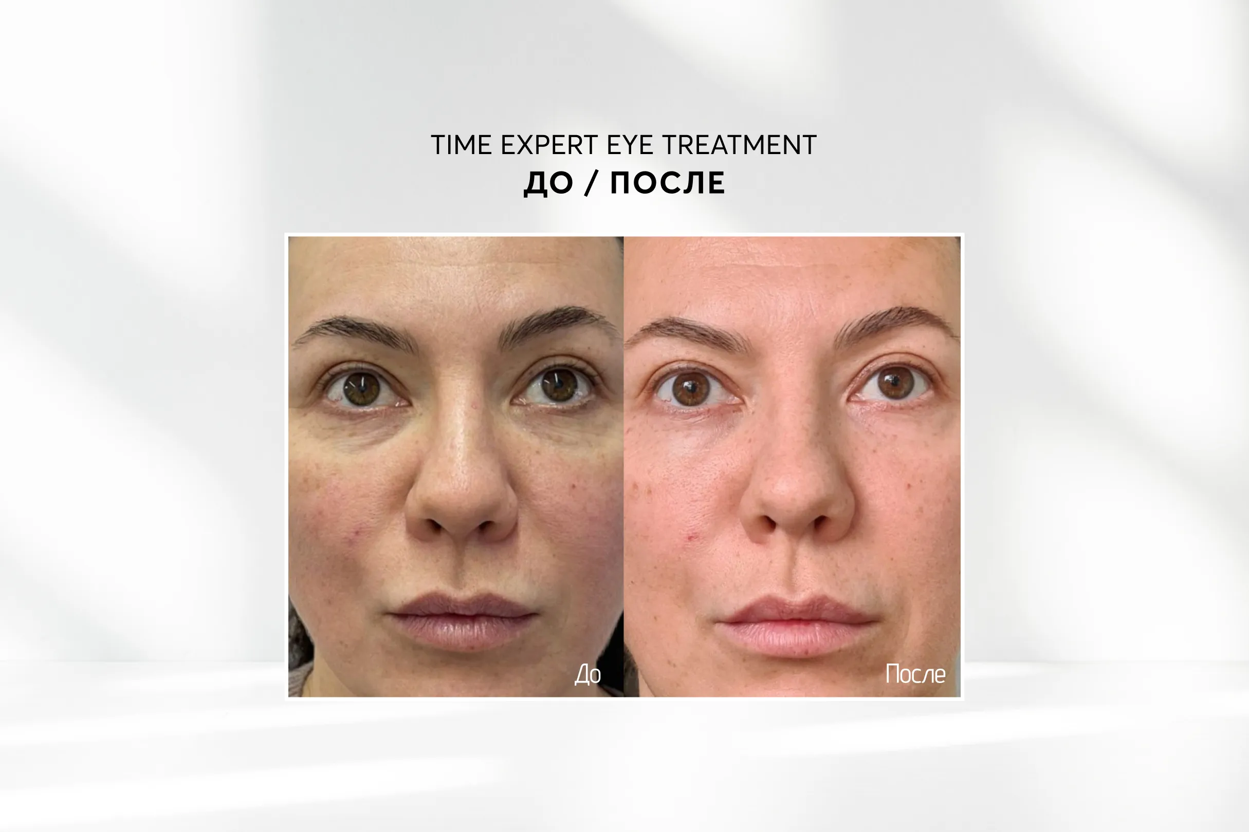 Крем для кожи вокруг глаз с лифтинг эффектом Skinjestique Time Expert Eye Treatment, 15 мл