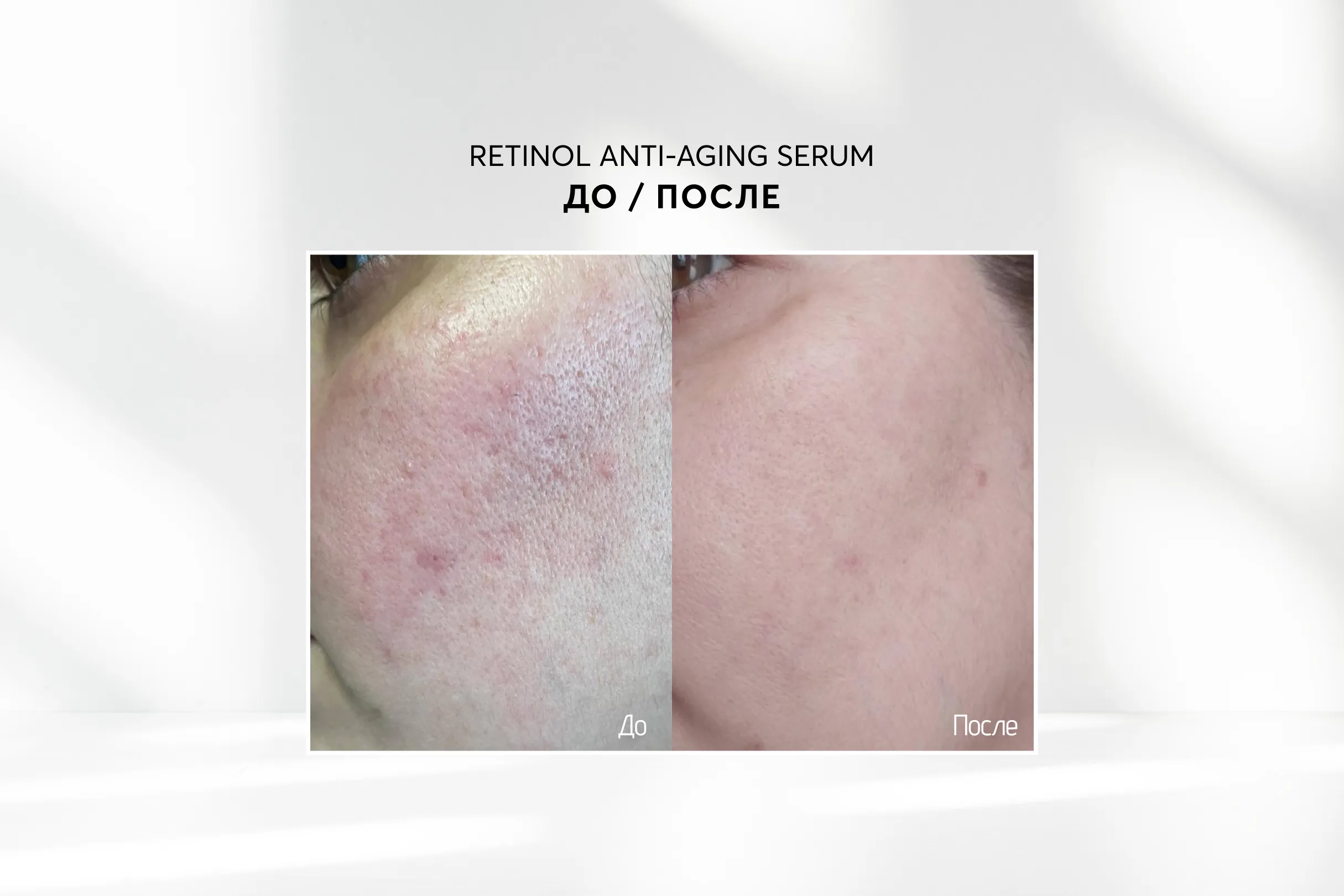 Лифтинг сыворотка для лица с ретинолом и пептидами Skinjestique Retinol Anti-aging serum, 30 мл