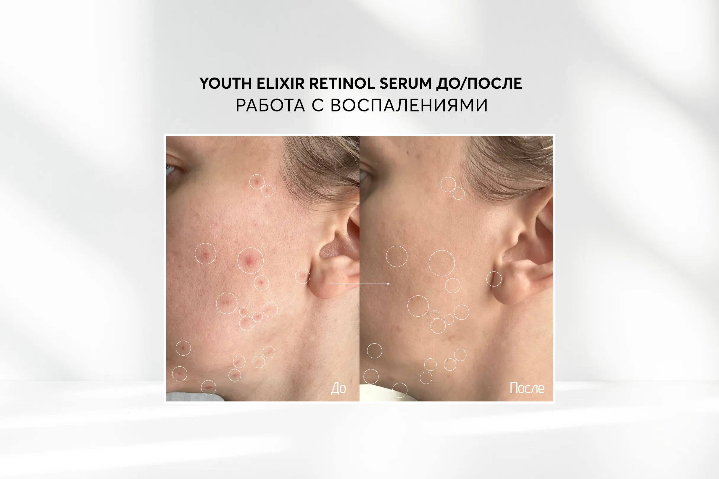 Ночная концентрированная сыворотка с ретинолом Skinjestique Youth elixir retinol serum, 30 мл