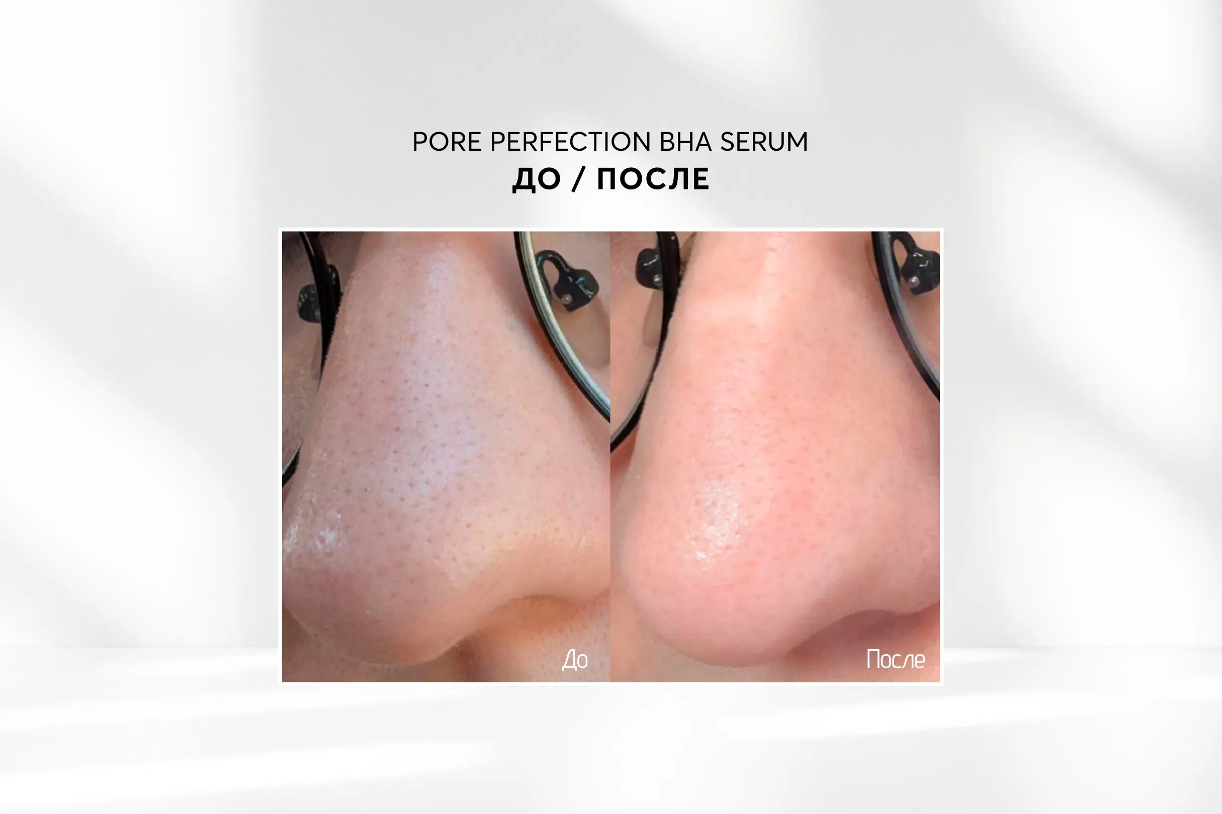 Сыворотка с ВНА-кислотой 2% Skinjestique Pore Perfection BHA serum, 30 мл