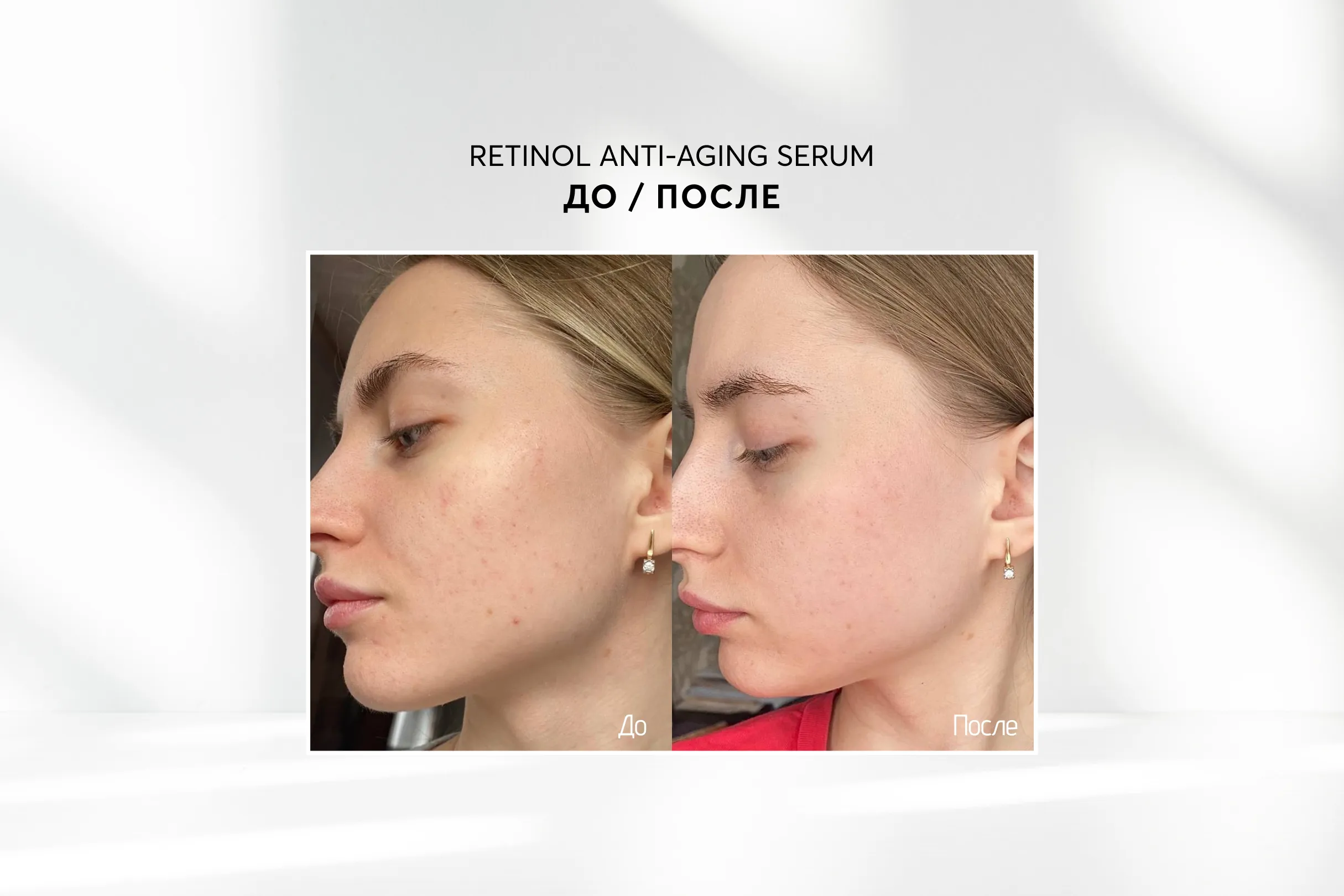 Лифтинг сыворотка для лица с ретинолом и пептидами Skinjestique Retinol Anti-aging serum, 30 мл